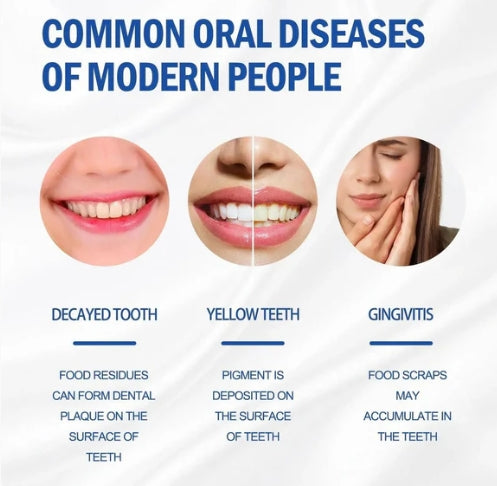 SP4 Ultra Whitening Probiotic Toothpaste