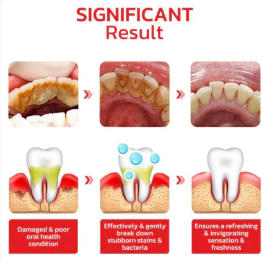 SP4 Ultra Whitening Probiotic Toothpaste